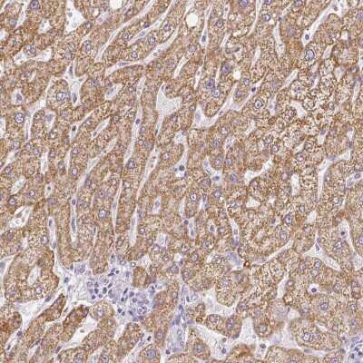 Immunohistochemistry: SUHW2 Antibody [NBP2-49299]