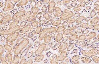 Immunohistochemistry-Paraffin: SUHW2 Antibody [NBP3-05966]