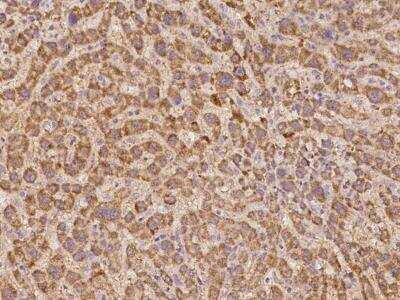 Immunohistochemistry-Paraffin: SUHW2 Antibody [NBP3-05966]