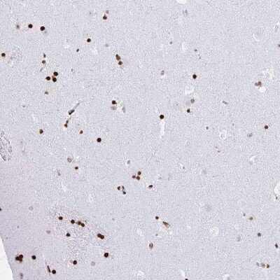 Immunohistochemistry: SUHW3 Antibody [NBP2-38768]