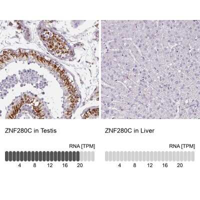 Immunohistochemistry-Paraffin: SUHW3 Antibody [NBP2-33618]