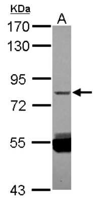 Western Blot: SUHW3 Antibody [NBP2-20530]