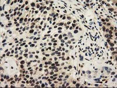 Immunohistochemistry-Paraffin: Cytosolic Sulfotransferase 1A1/SULT1A1 Antibody (OTI9B7) [NBP2-03227]