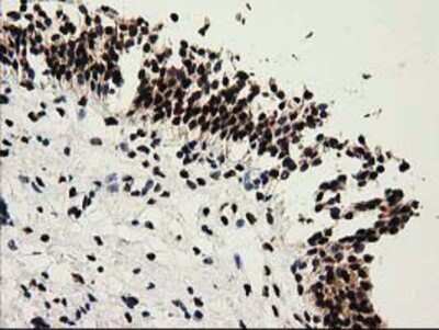 Immunohistochemistry-Paraffin: Cytosolic Sulfotransferase 1A1/SULT1A1 Antibody (OTI9B7) [NBP2-03227]