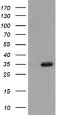 Western Blot: Cytosolic Sulfotransferase 1A1/SULT1A1 Antibody (OTI9B7) [NBP2-03227]