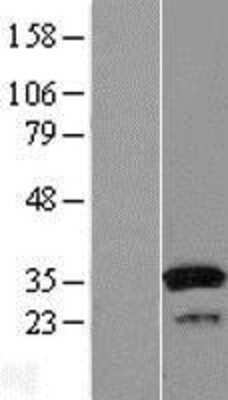 Western Blot: Cytosolic Sulfotransferase 1A1/SULT1A1 Overexpression Lysate [NBL1-16600]