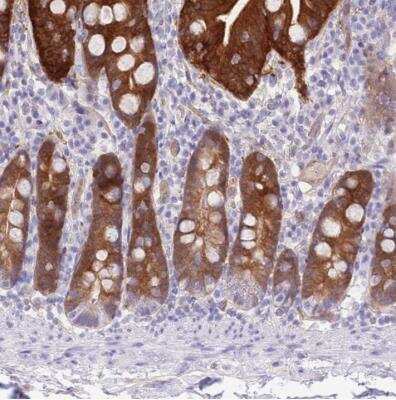 Immunohistochemistry-Paraffin: SULT1A2 Antibody [NBP2-31904]