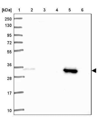 Western Blot: SULT1A2 Antibody [NBP2-31904]