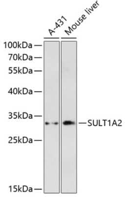 Western Blot: SULT1A2 AntibodyAzide and BSA Free [NBP2-93418]