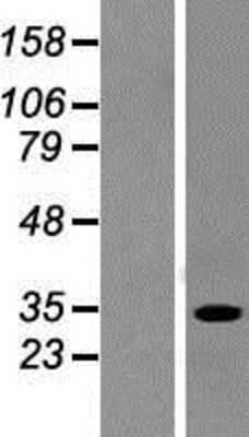 Western Blot: SULT1A2 Overexpression Lysate [NBP2-08338]