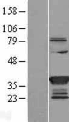 Western Blot: Cytosolic Sulfotransferase 1C2/SULT1C2 Overexpression Lysate [NBL1-16605]