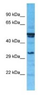 Western Blot: SULT1C3 Antibody [NBP3-09936]