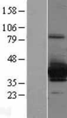 Western Blot: Cytosolic Sulfotransferase 4A1/SULT4A1 Overexpression Lysate [NBL1-16609]