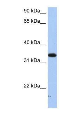 Western Blot: SULT6B1 Antibody [NBP1-91326]