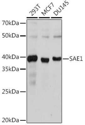 Western Blot: SUMO Activating Enzyme E1 (SAE1) Antibody (0L2N2) [NBP3-15317]