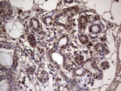 Immunohistochemistry: SUMO Activating Enzyme E1 (SAE1) Antibody (OTI6B11) [NBP2-45683]