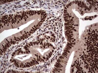 Immunohistochemistry: SUMO Activating Enzyme E1 (SAE1) Antibody (OTI6B11) [NBP2-45683]
