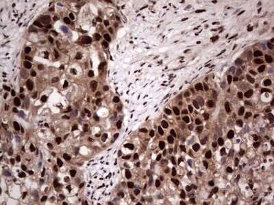 Immunohistochemistry: SUMO Activating Enzyme E1 (SAE1) Antibody (OTI6B11) [NBP2-45683]