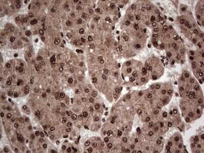Immunohistochemistry: SUMO Activating Enzyme E1 (SAE1) Antibody (OTI6B11) [NBP2-45683]