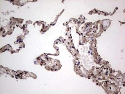 Immunohistochemistry: SUMO Activating Enzyme E1 (SAE1) Antibody (OTI6B11) [NBP2-45683]
