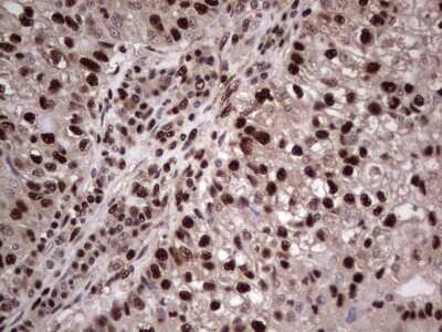 Immunohistochemistry: SUMO Activating Enzyme E1 (SAE1) Antibody (OTI6B11) [NBP2-45683]