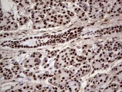 Immunohistochemistry: SUMO Activating Enzyme E1 (SAE1) Antibody (OTI6B11) [NBP2-45683]