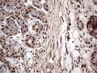 Immunohistochemistry: SUMO Activating Enzyme E1 (SAE1) Antibody (OTI6B11) [NBP2-45683]