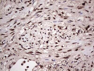 Immunohistochemistry: SUMO Activating Enzyme E1 (SAE1) Antibody (OTI6B11) [NBP2-45683]
