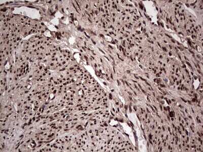 Immunohistochemistry: SUMO Activating Enzyme E1 (SAE1) Antibody (OTI6B11) [NBP2-45683]