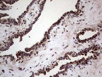 Immunohistochemistry: SUMO Activating Enzyme E1 (SAE1) Antibody (OTI6B11) [NBP2-45683]