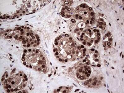 Immunohistochemistry: SUMO Activating Enzyme E1 (SAE1) Antibody (OTI6B11) [NBP2-45683]