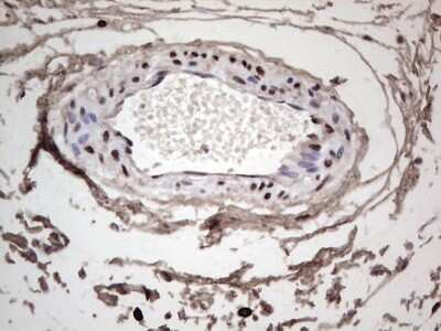 Immunohistochemistry: SUMO Activating Enzyme E1 (SAE1) Antibody (OTI6B11) [NBP2-45683]