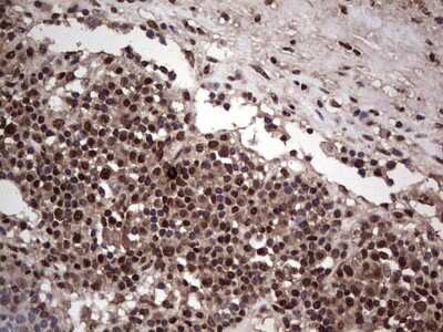 Immunohistochemistry: SUMO Activating Enzyme E1 (SAE1) Antibody (OTI6B11) [NBP2-45683]