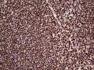 Immunohistochemistry: SUMO Activating Enzyme E1 (SAE1) Antibody (OTI6B11) [NBP2-45683]