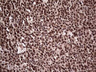 Immunohistochemistry: SUMO Activating Enzyme E1 (SAE1) Antibody (OTI6B11) [NBP2-45683]