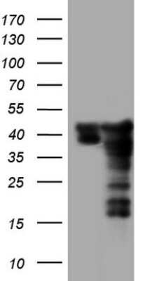 Western Blot: SUMO Activating Enzyme E1 (SAE1) Antibody (OTI6B11) [NBP2-45683]