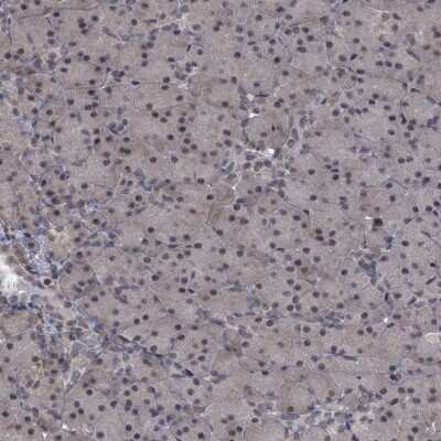 Immunohistochemistry-Paraffin: SUMO Activating Enzyme E1 (SAE1) Antibody [NBP2-13272]