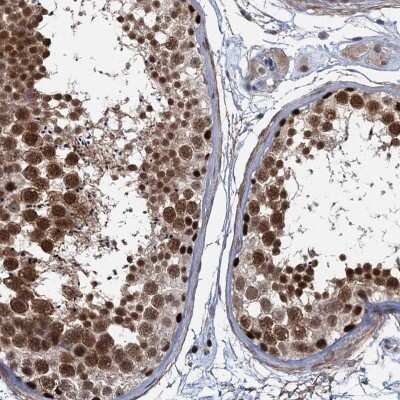 Immunohistochemistry-Paraffin: SUMO Activating Enzyme E1 (SAE1) Antibody [NBP2-13272]