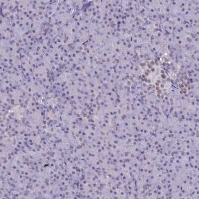 Immunohistochemistry-Paraffin: SUMO Activating Enzyme E1 (SAE1) Antibody [NBP2-13273]