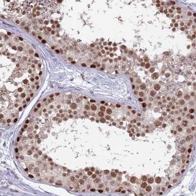 Immunohistochemistry-Paraffin: SUMO Activating Enzyme E1 (SAE1) Antibody [NBP2-13273]