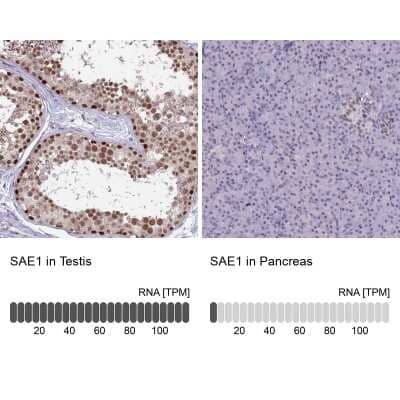 Immunohistochemistry-Paraffin: SUMO Activating Enzyme E1 (SAE1) Antibody [NBP2-13273]