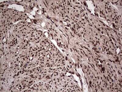 Immunohistochemistry: SUMO Activating Enzyme E1 (SAE1) Antibody (OTI6B11) - Azide and BSA Free [NBP2-74410]