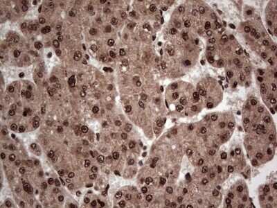 Immunohistochemistry: SUMO Activating Enzyme E1 (SAE1) Antibody (OTI6B11) - Azide and BSA Free [NBP2-74410]