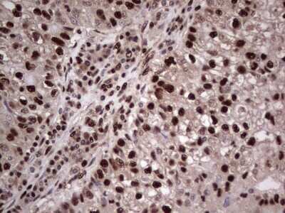 Immunohistochemistry: SUMO Activating Enzyme E1 (SAE1) Antibody (OTI6B11) - Azide and BSA Free [NBP2-74410]