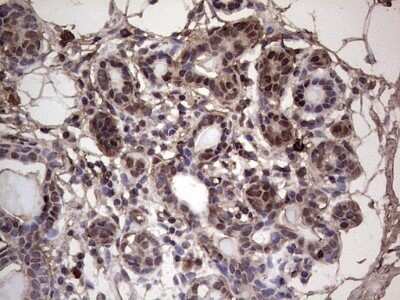 Immunohistochemistry: SUMO Activating Enzyme E1 (SAE1) Antibody (OTI6B11) - Azide and BSA Free [NBP2-74410]