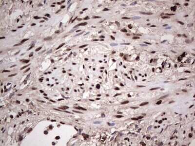 Immunohistochemistry: SUMO Activating Enzyme E1 (SAE1) Antibody (OTI6B11) - Azide and BSA Free [NBP2-74410]