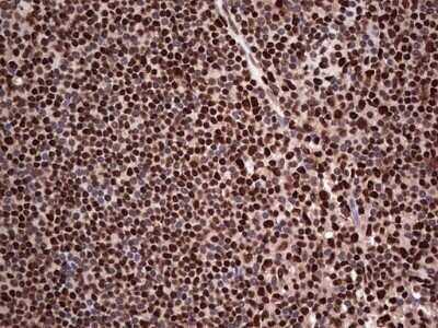 Immunohistochemistry: SUMO Activating Enzyme E1 (SAE1) Antibody (OTI6B11) - Azide and BSA Free [NBP2-74410]