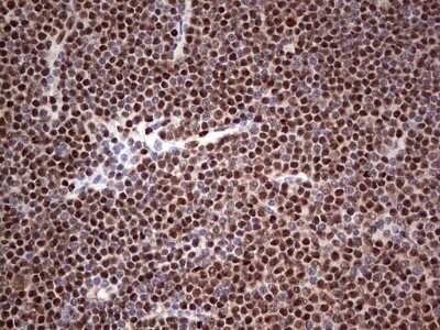 Immunohistochemistry: SUMO Activating Enzyme E1 (SAE1) Antibody (OTI6B11) - Azide and BSA Free [NBP2-74410]
