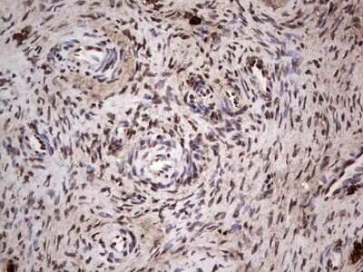 Immunohistochemistry: SUMO Activating Enzyme E1 (SAE1) Antibody (OTI6B11) - Azide and BSA Free [NBP2-74410]