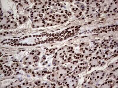 Immunohistochemistry: SUMO Activating Enzyme E1 (SAE1) Antibody (OTI6B11) - Azide and BSA Free [NBP2-74410]